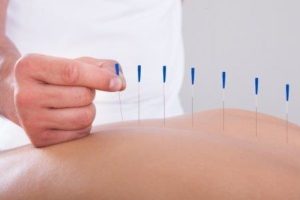 Is there any value in pursuing acupuncture for infertility?